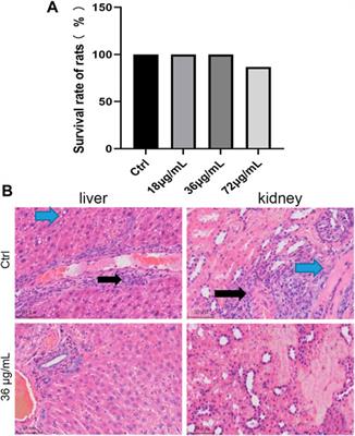 Radioprotective effect of polyvinylpyrrolidone modified selenium nanoparticles and its antioxidation mechanism in vitro and in vivo